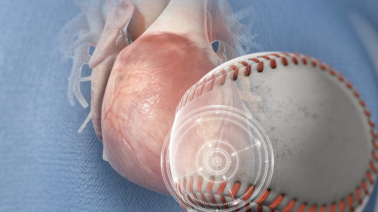 Commotio Cordis (3D Animation)