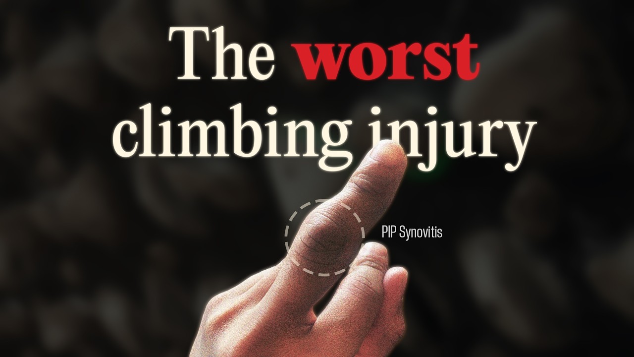 The Art of Starting Over: climbing injuries and recovery (feat. @HoopersBeta )