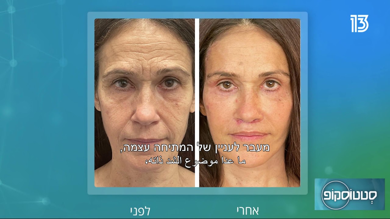 ד
