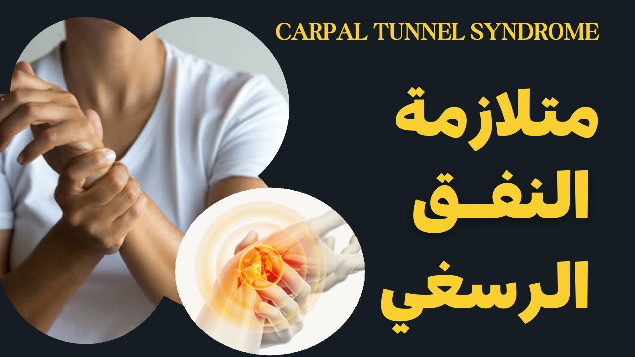 Carpal tunnel syndrome| متلازمة النفق الرسغي | الاعراض | الاسباب | التمارين| العلاجات والجراحة