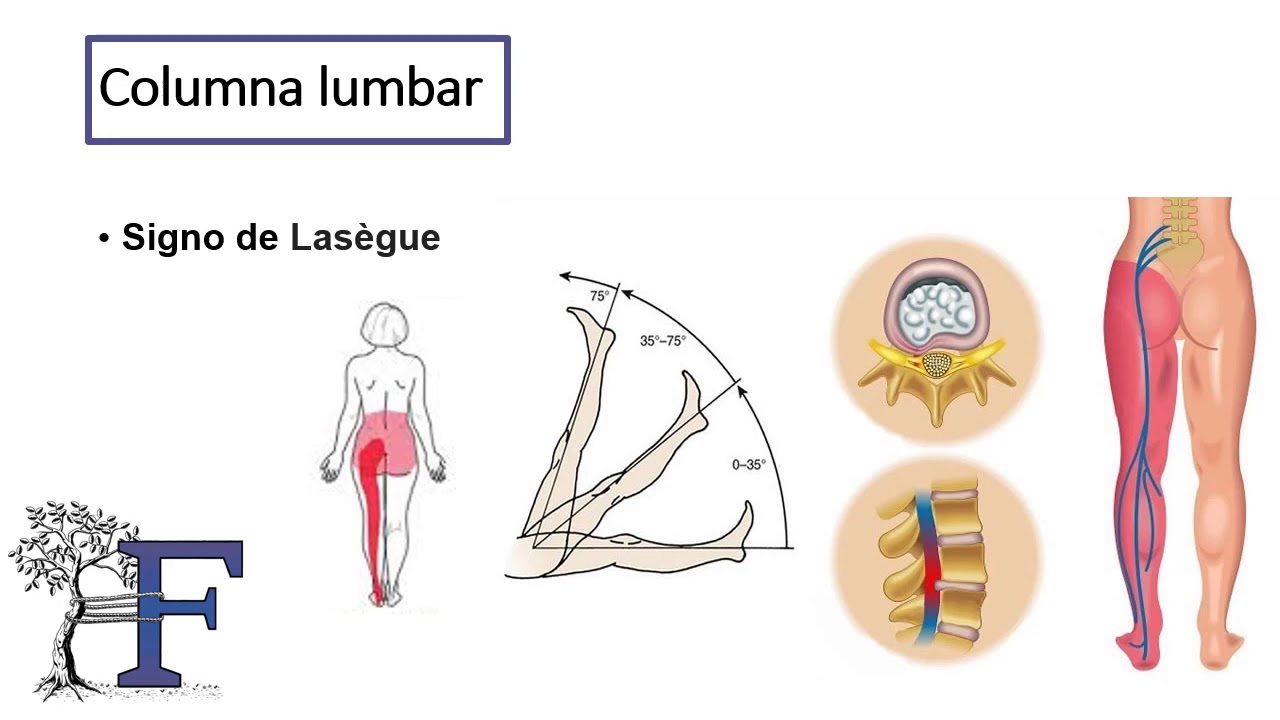 Semiología de la columna vertebral