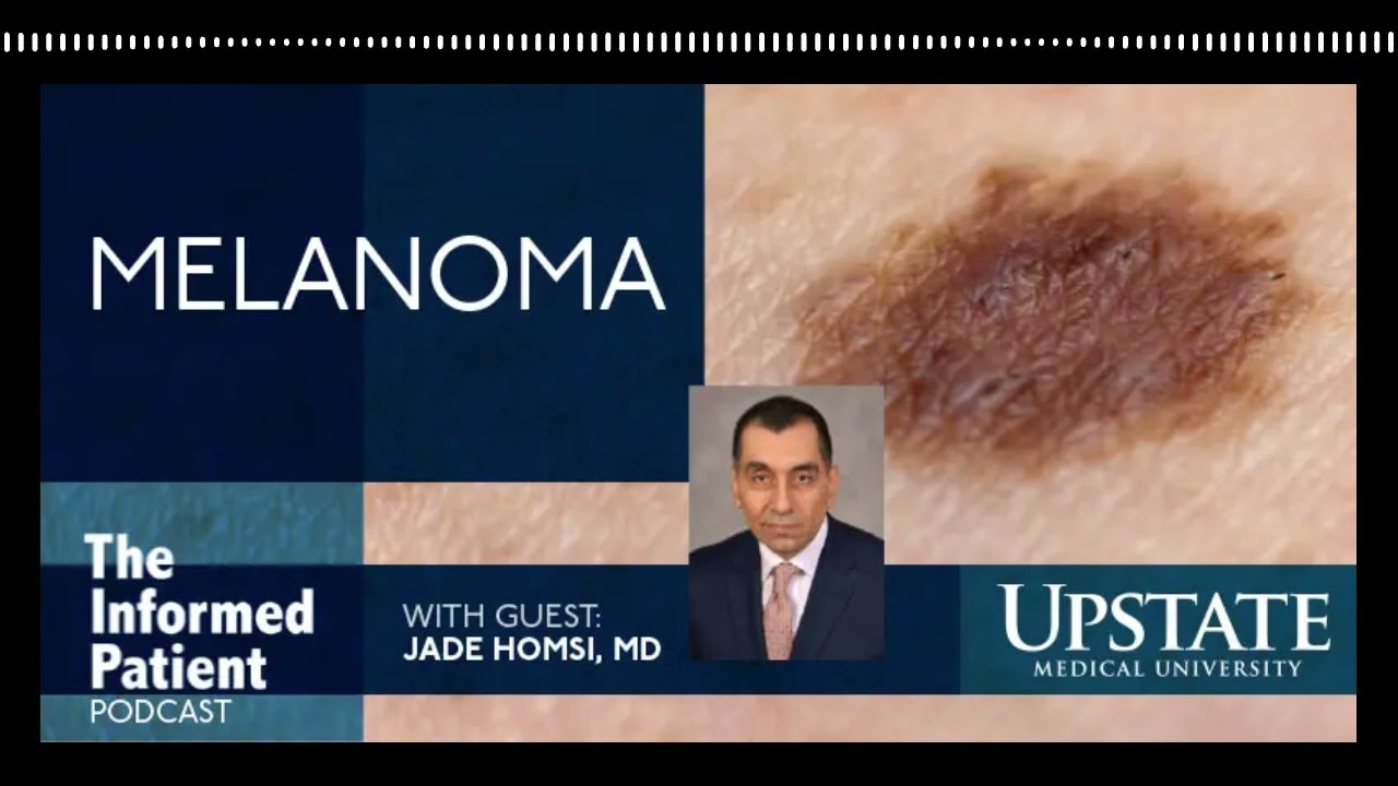 Diagnosis, treatment and outlook for melanoma