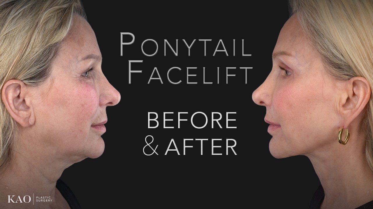 Ponytail Facelift - It's More Than A Name... More Than Just Plastic Surgery. It's My Life's Work.