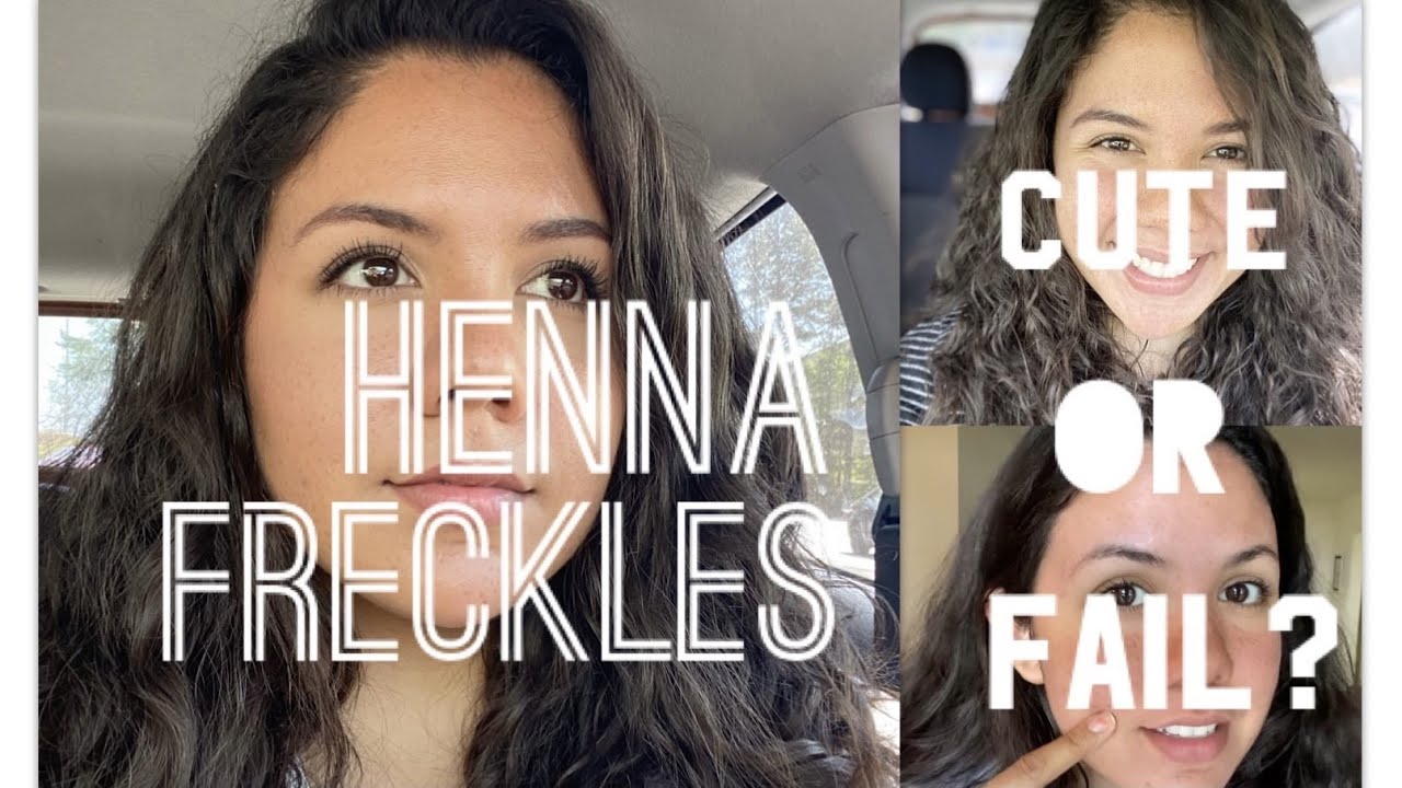 Hiding Acne Scars with Henna Freckles| Did It Work?| How Long Do They Last?
