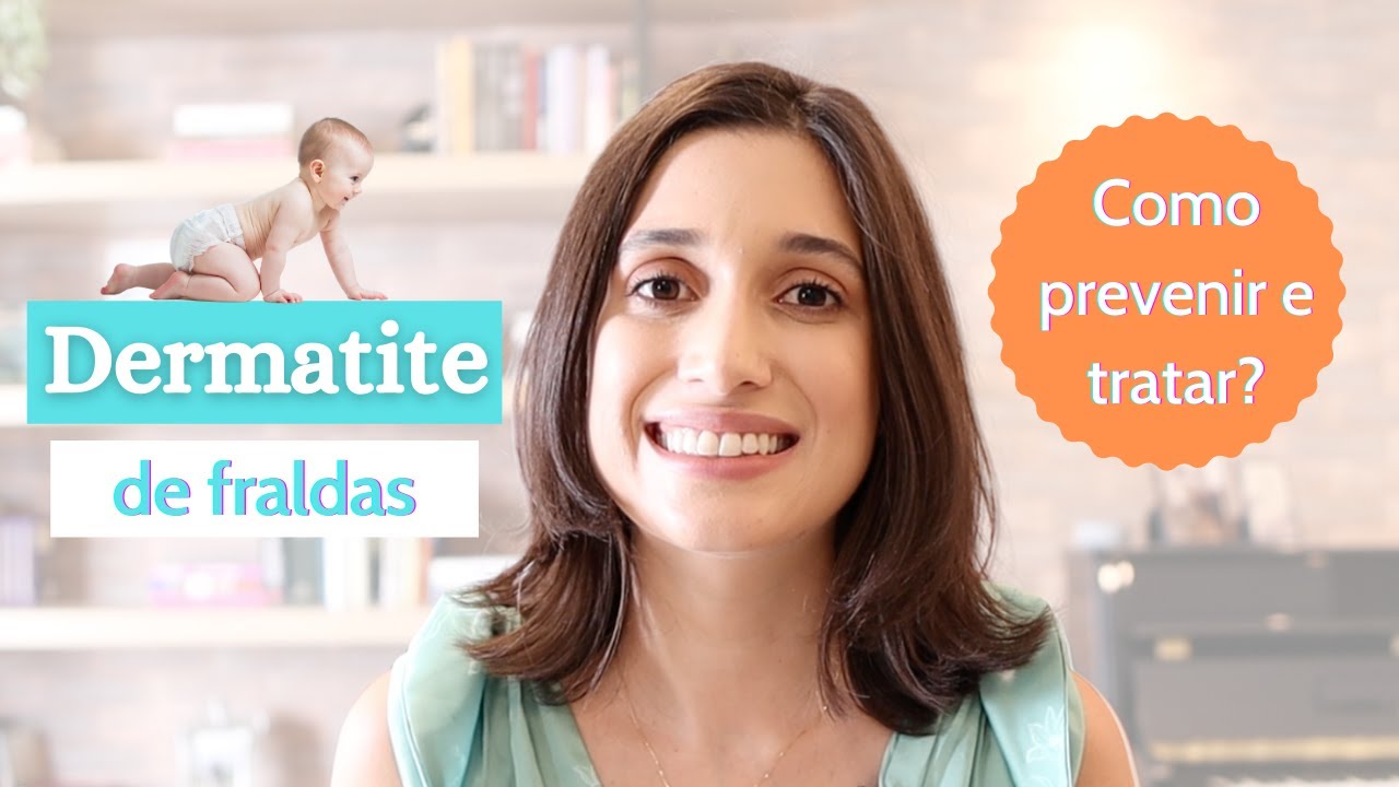 Assadura e Dermatite de FRALDAS: Dermatologista dá orientações importantes!