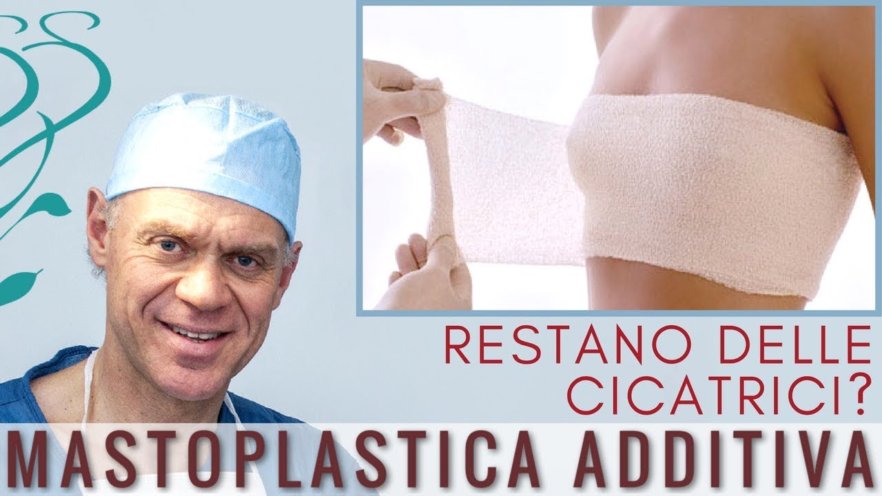 Mastoplastica Additiva: dove sono le cicatrici?