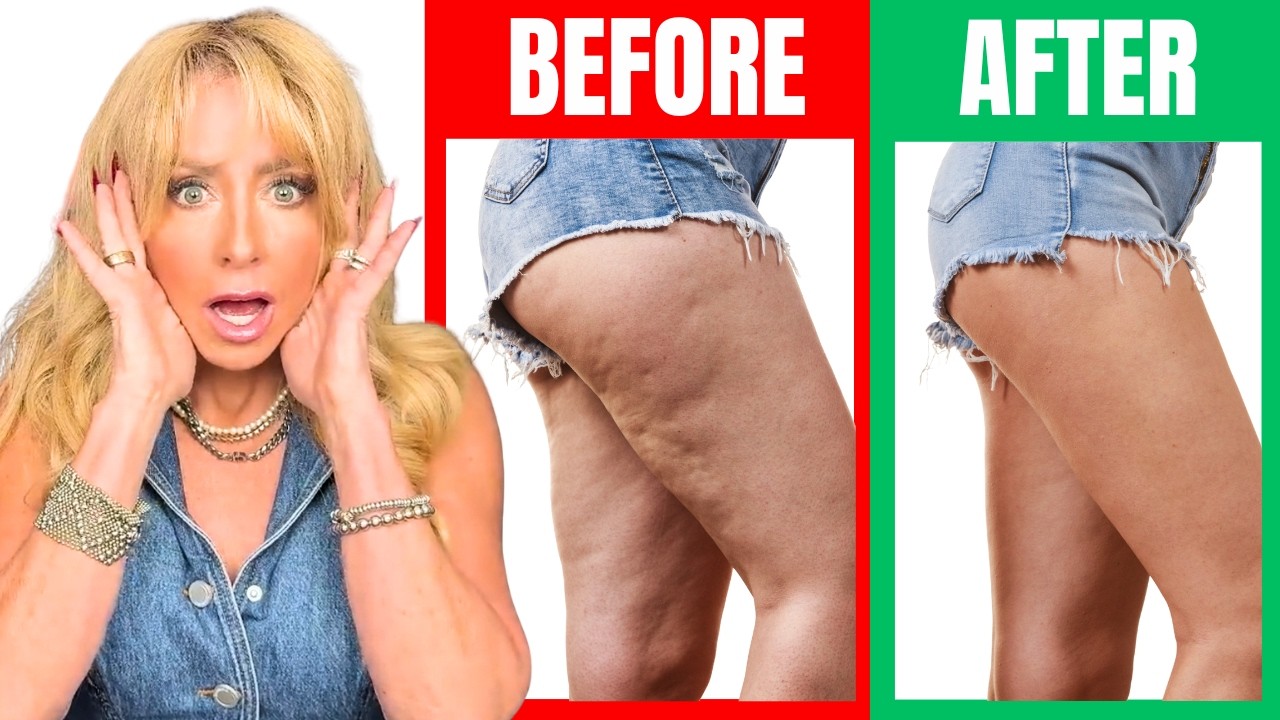 17 Science-Backed Ways to Fix Cellulite in Women Over 40