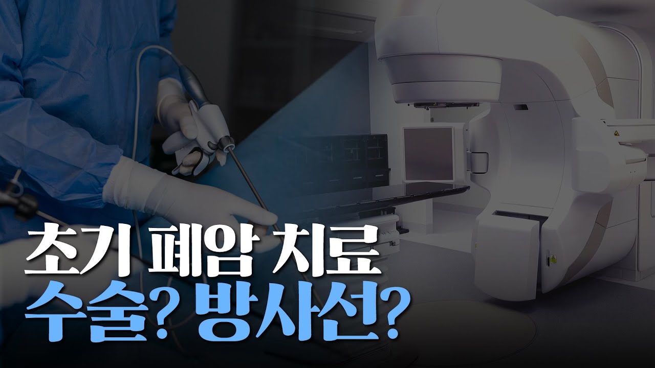수술 vs 방사선치료? 초기 폐암 환자의 상황별 치료법 정리!｜암행의사