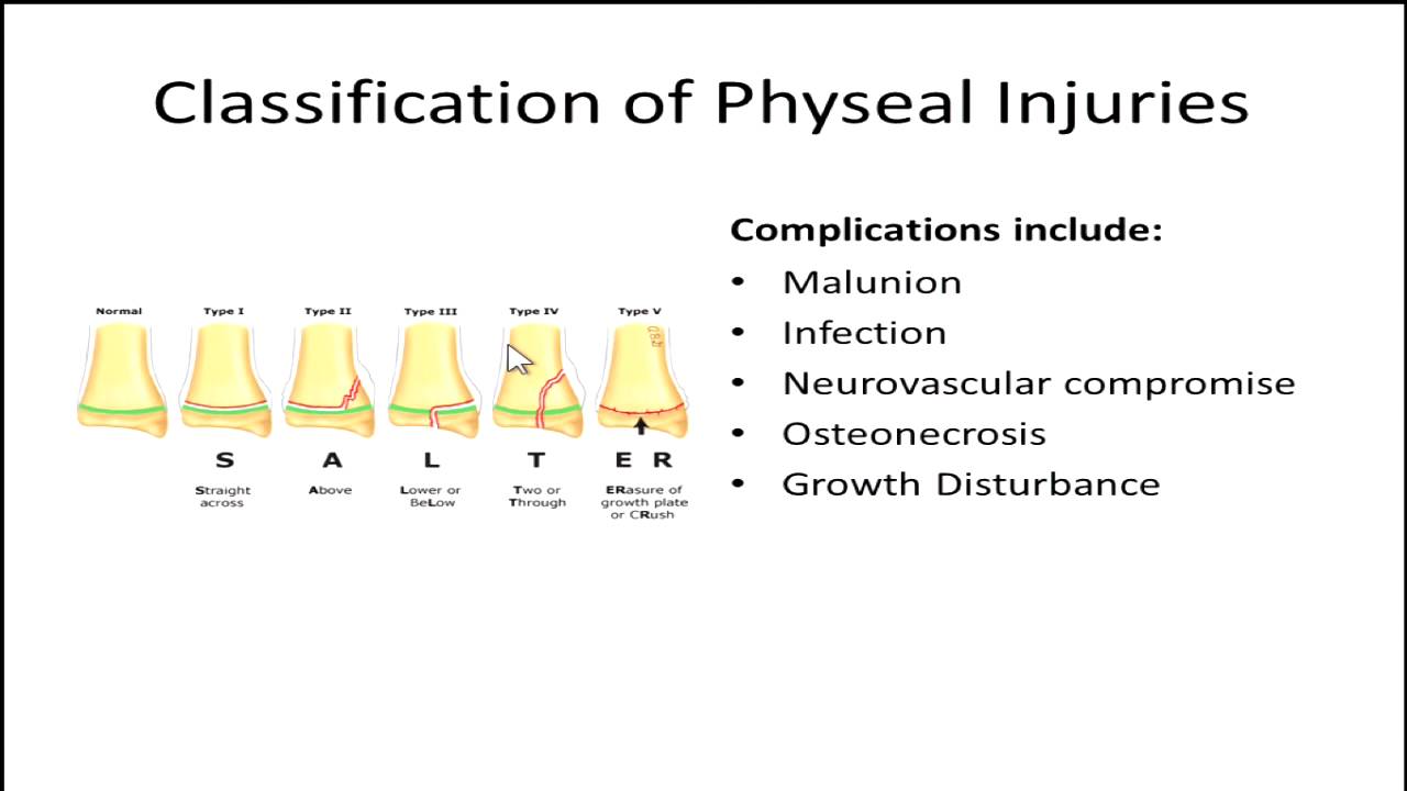 The pediatric polytrauma patient