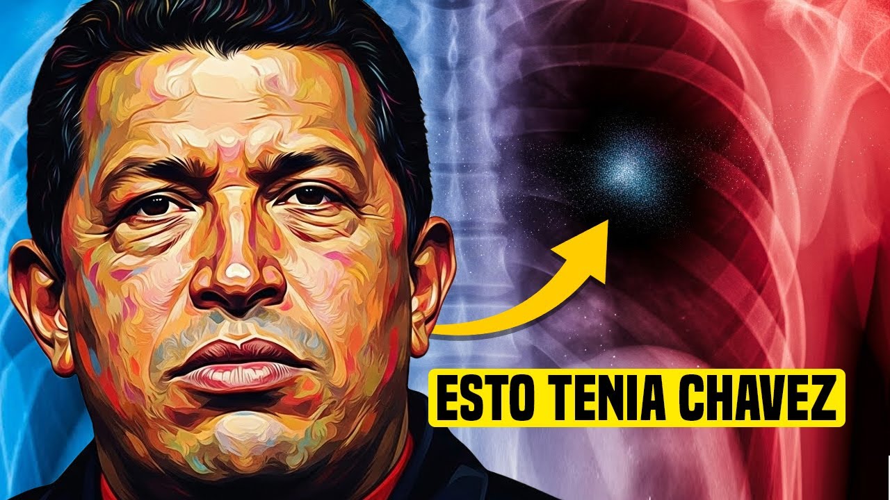 La Enfermedad Oculta de Chávez Una Historia No Contada