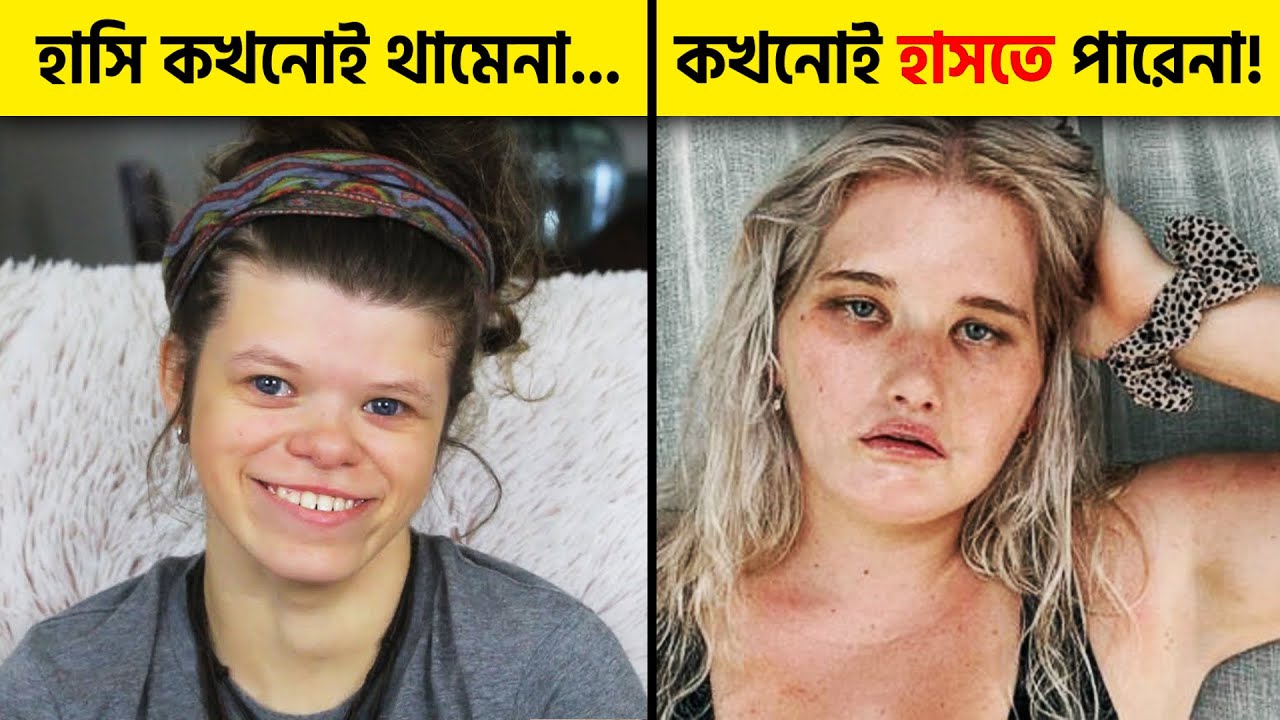 পৃথিবীর সবচেয়ে অদ্ভুত ১০ রোগ – ডাক্তারের মাথা নষ্ট! Extremely Weird Diseases | Pinikpi