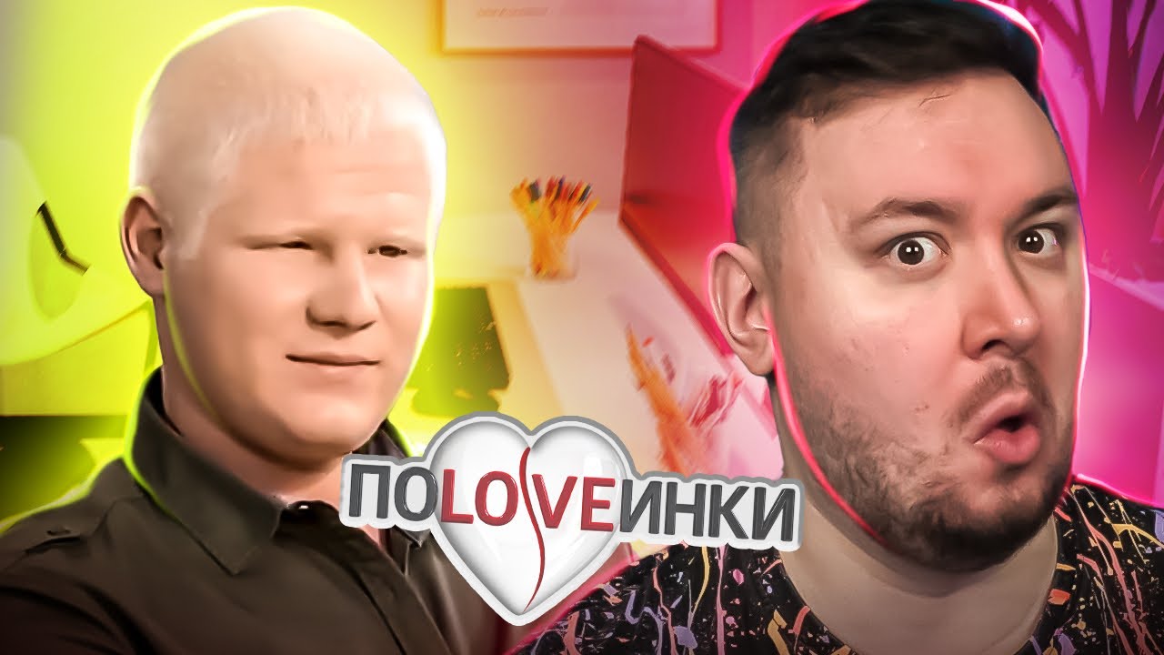 Половинки ► Человек АЛЬБИНОС