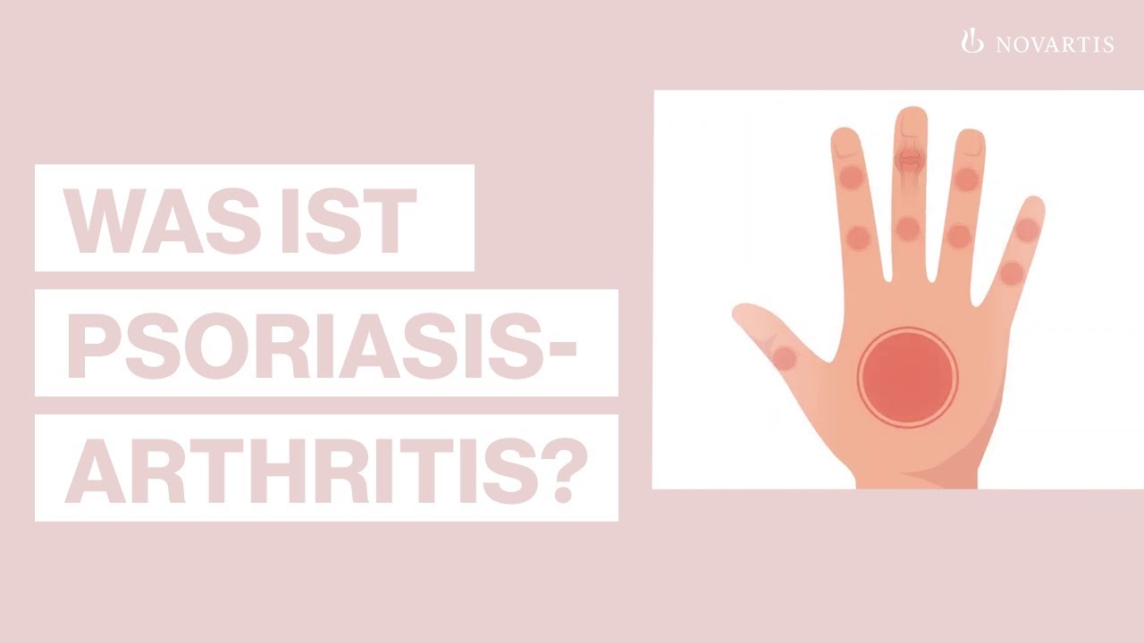 Psoriasis Arthritis einfach erkl&auml;rt