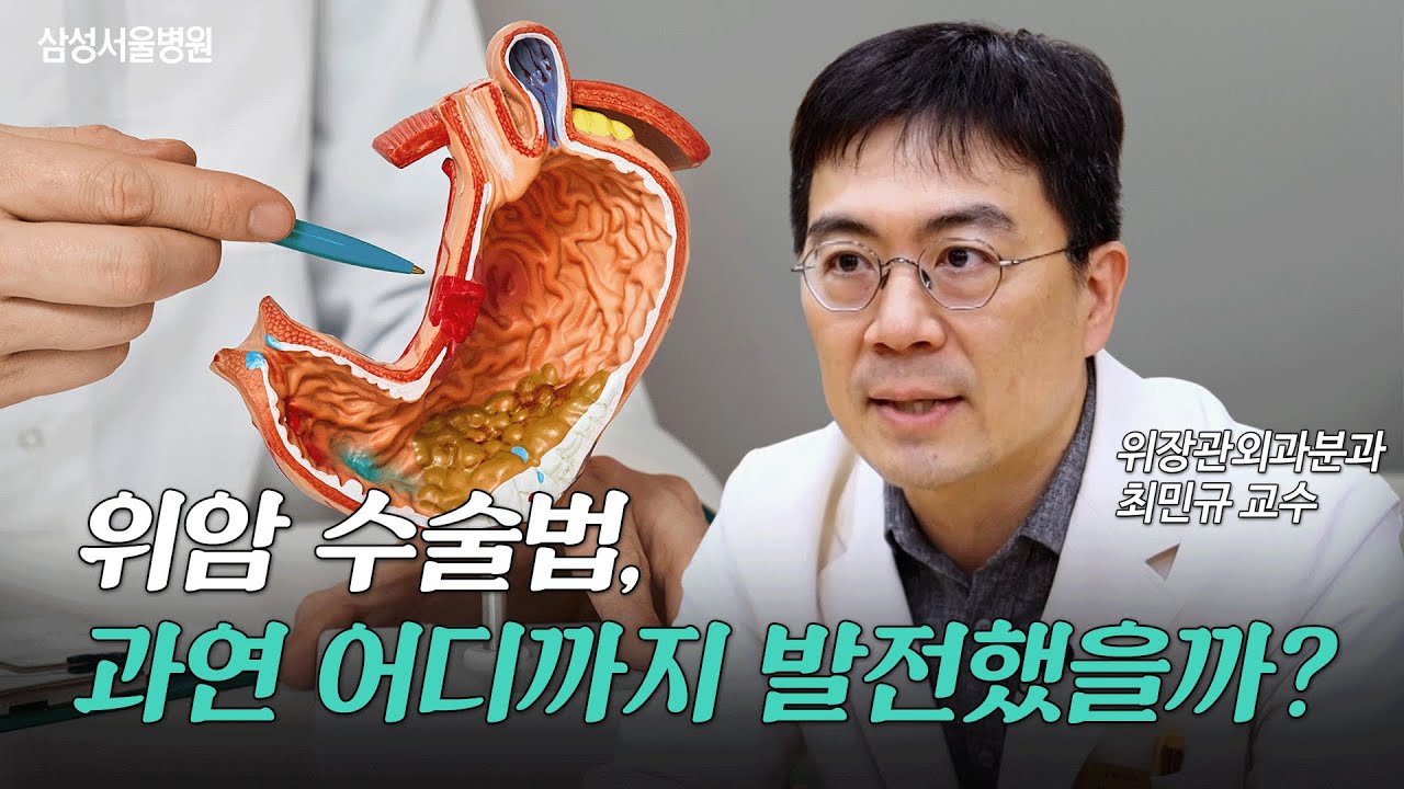 환자마다 맞는 수술법도 여러가지🩺 꼭 알아 두어야 할 위암 수술법&관리법 (위장관외과 최민규 교수)