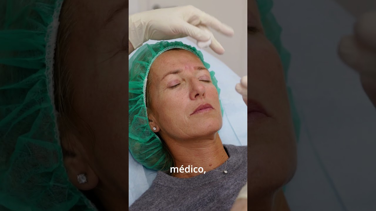Tratamiento antiarrugas (antes y despues) -  Terapia Regenerativa