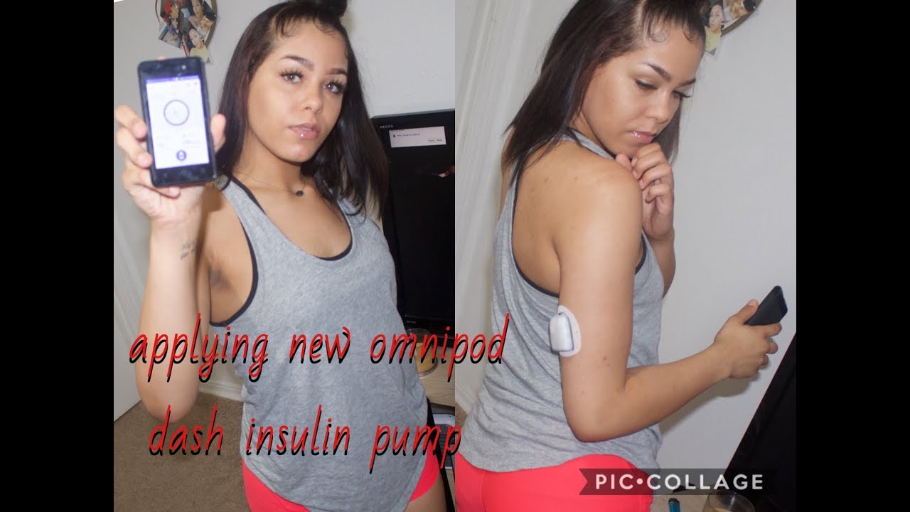 Omnipod Dash Insulin Pump Apply | typeone_brie