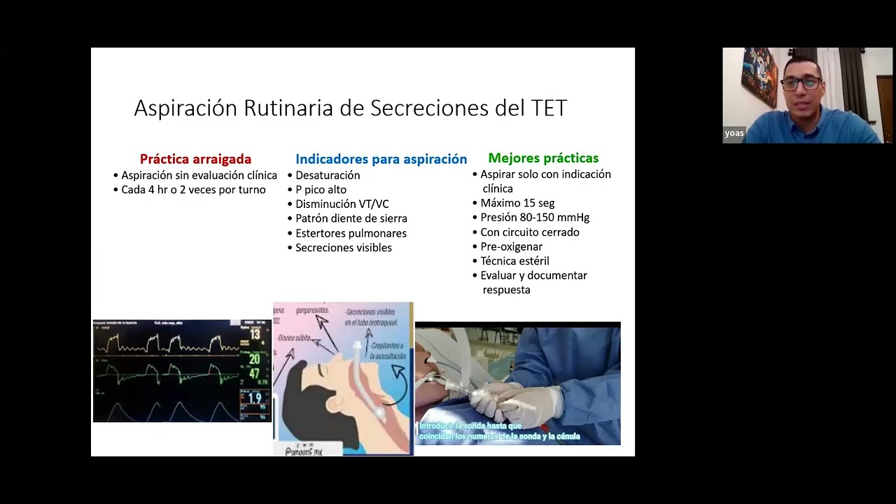 Errores en Intervenciones de Enfermería menos es mas