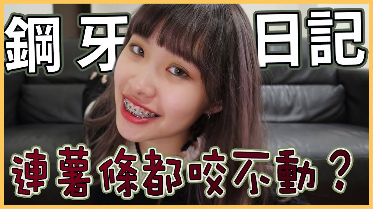 戴蒙牙套新手的心得分享！！連薯條都咬不動?!||Sam&Aïcha