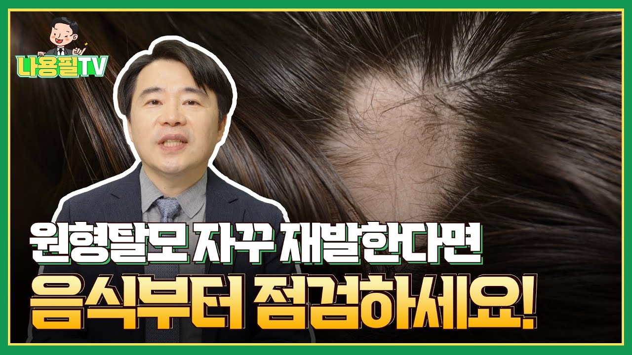 식습관이 원형 탈모에 끼치는 영향! 어느 정도인지 알아봅시다! #광주탈모치료