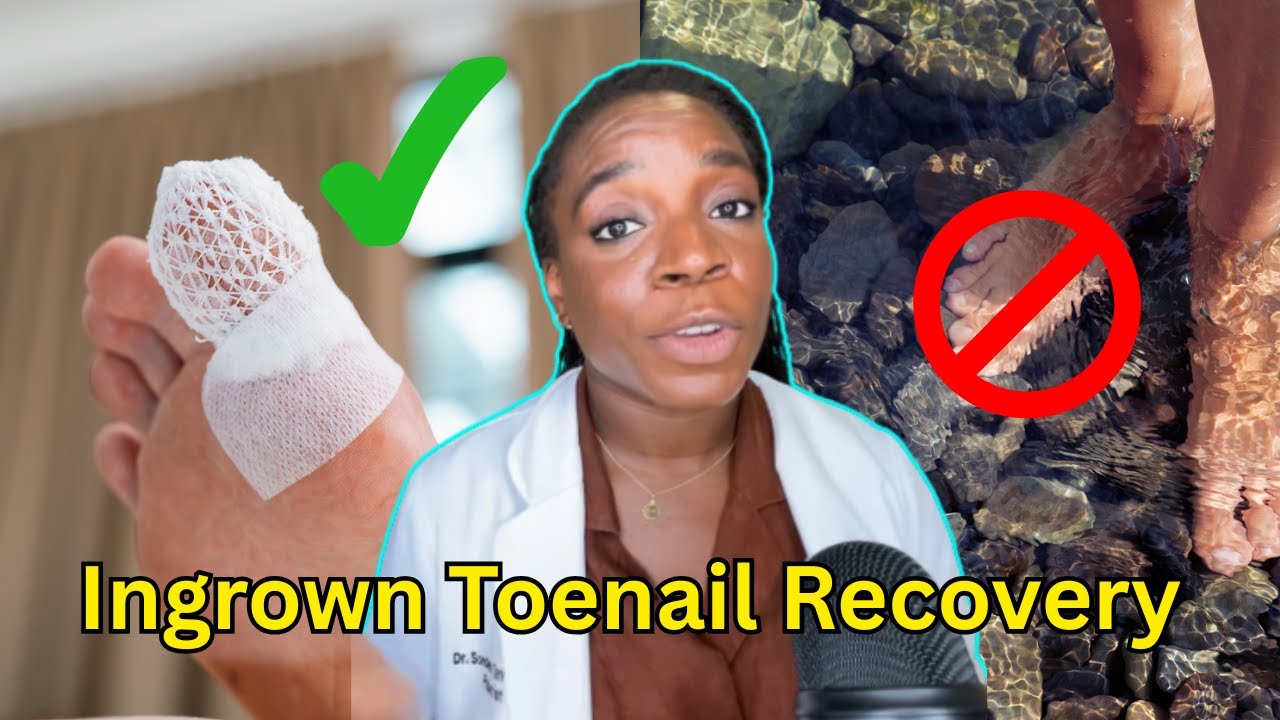 6 Easy Tips for Ingrown Toenail Removal Recovery | Dr. Tarr