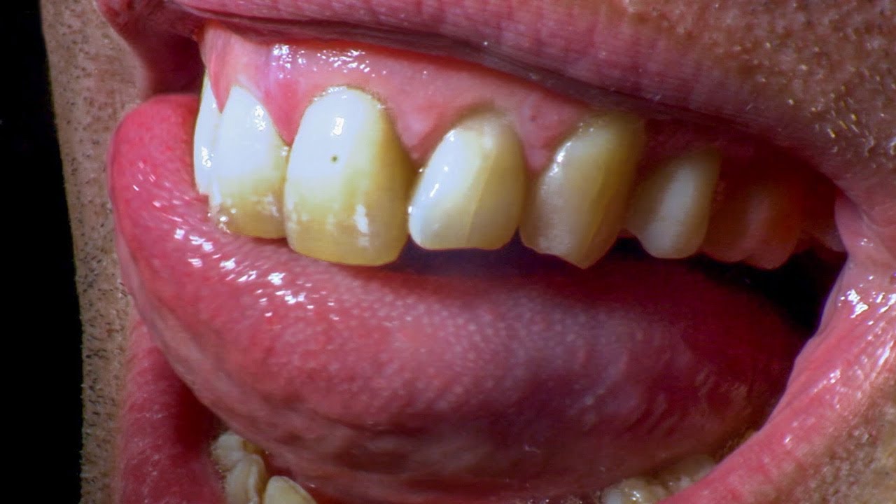 What Happens When You Don't Brush Your Teeth? | Earth Science
