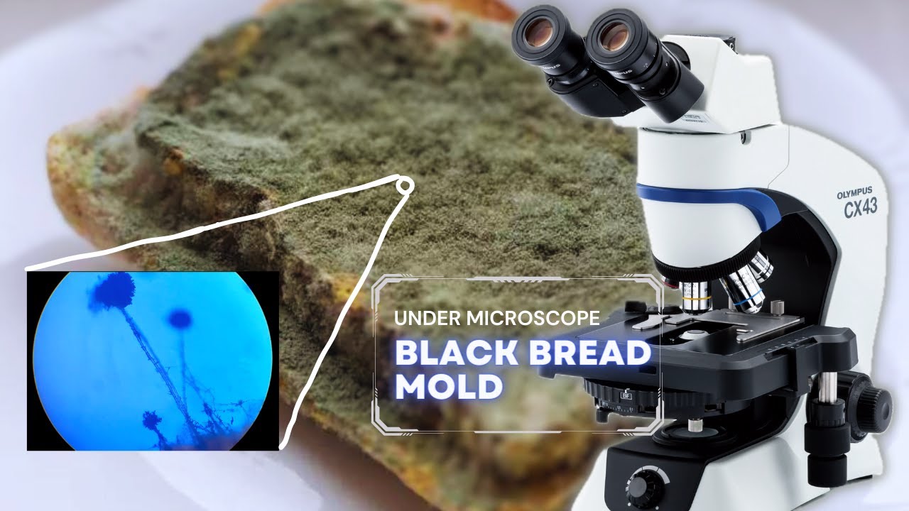 How to watch the Bread Mold/Fungus under the Microscope | Mesmerizing Microscopic Views!