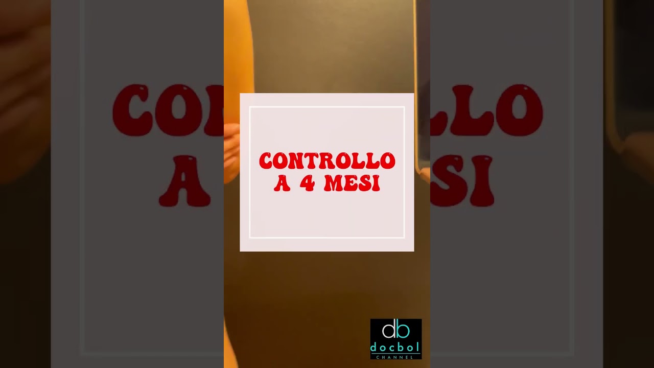Diastasi muscoli retti