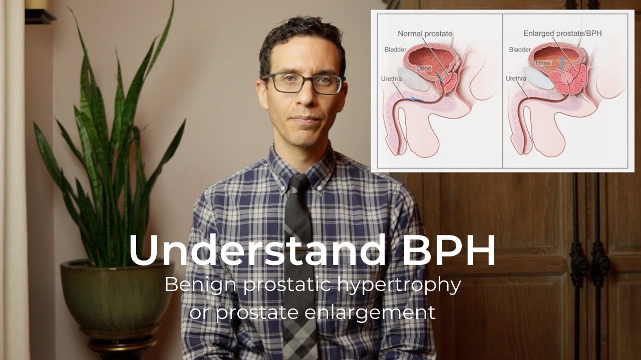Urologist explains the basics of BPH | prostate enlargement | benign prostatic hypertrophy