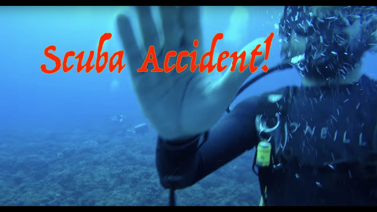 My scuba accident - passed out! Needed CPR.