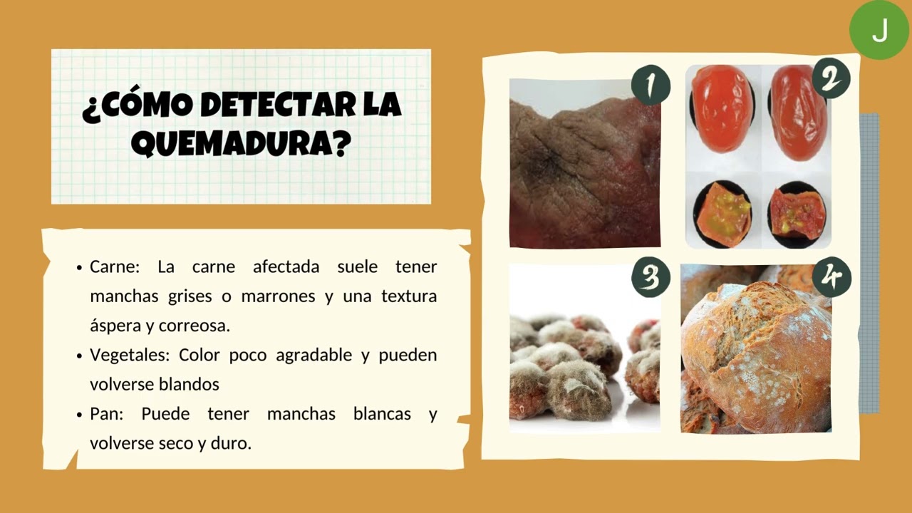 Quemadura por Congelaci&oacute;n