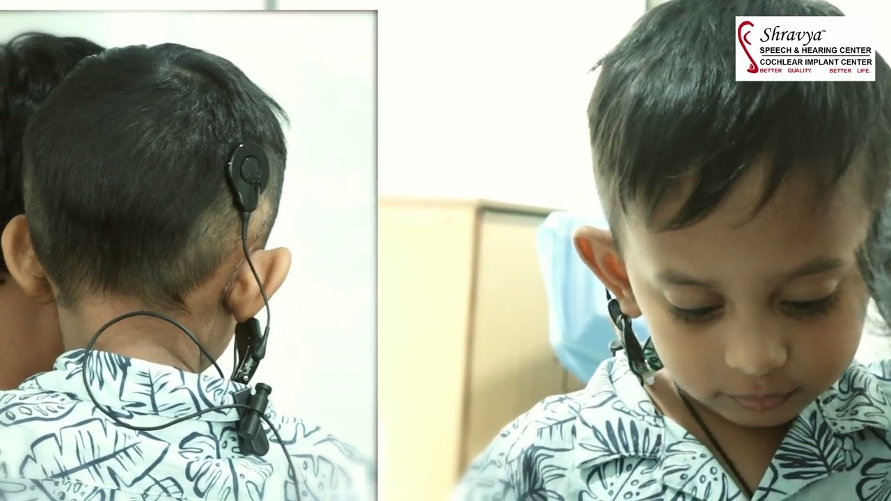 Successful Switch-On of CI632 (N8) Cochlear Implant — Devarsh  #cochlearimplant #hearingimpairment