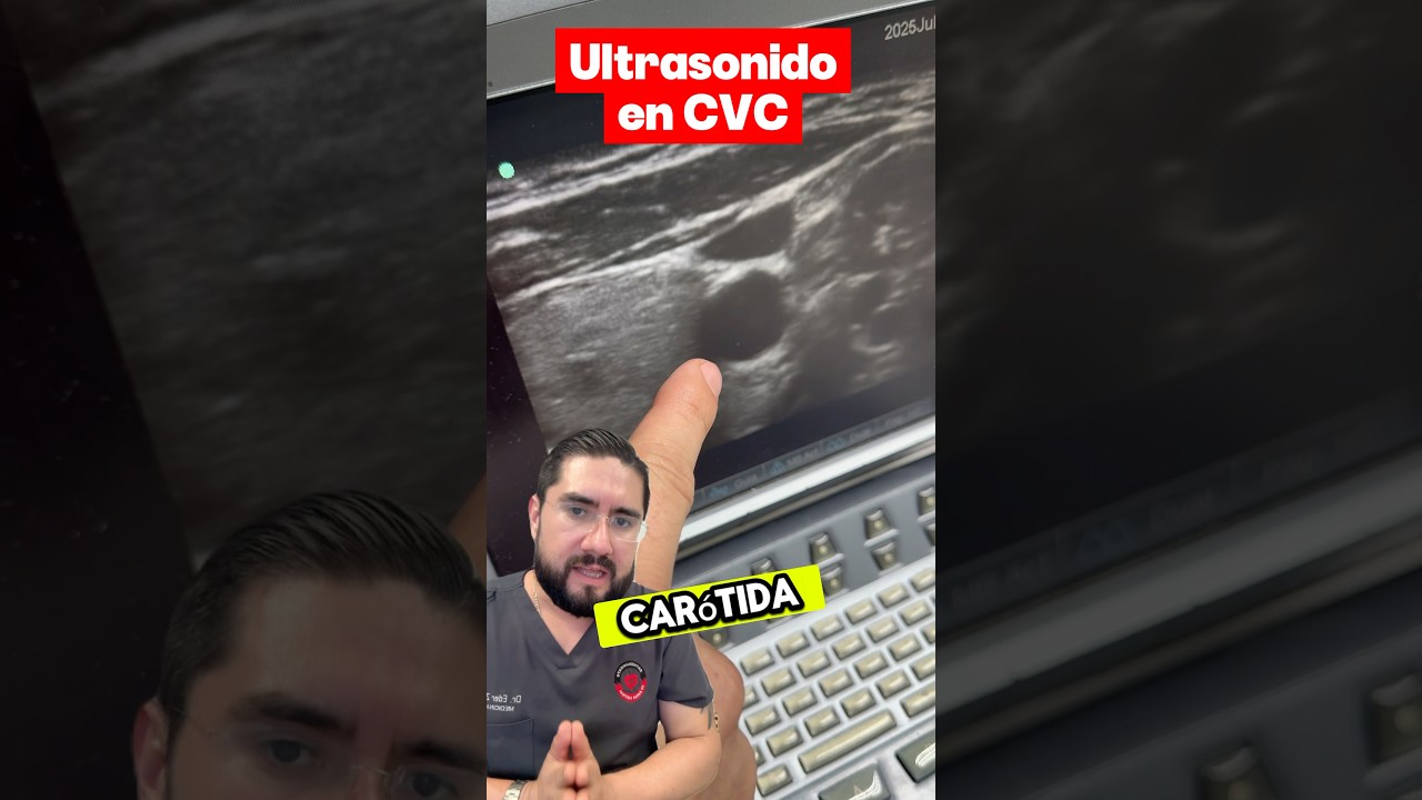 &iquest;Por qu&eacute; utilizar ultrasonido en la colocaci&oacute;n de un cat&eacute;ter venoso central? #emergencias #uci