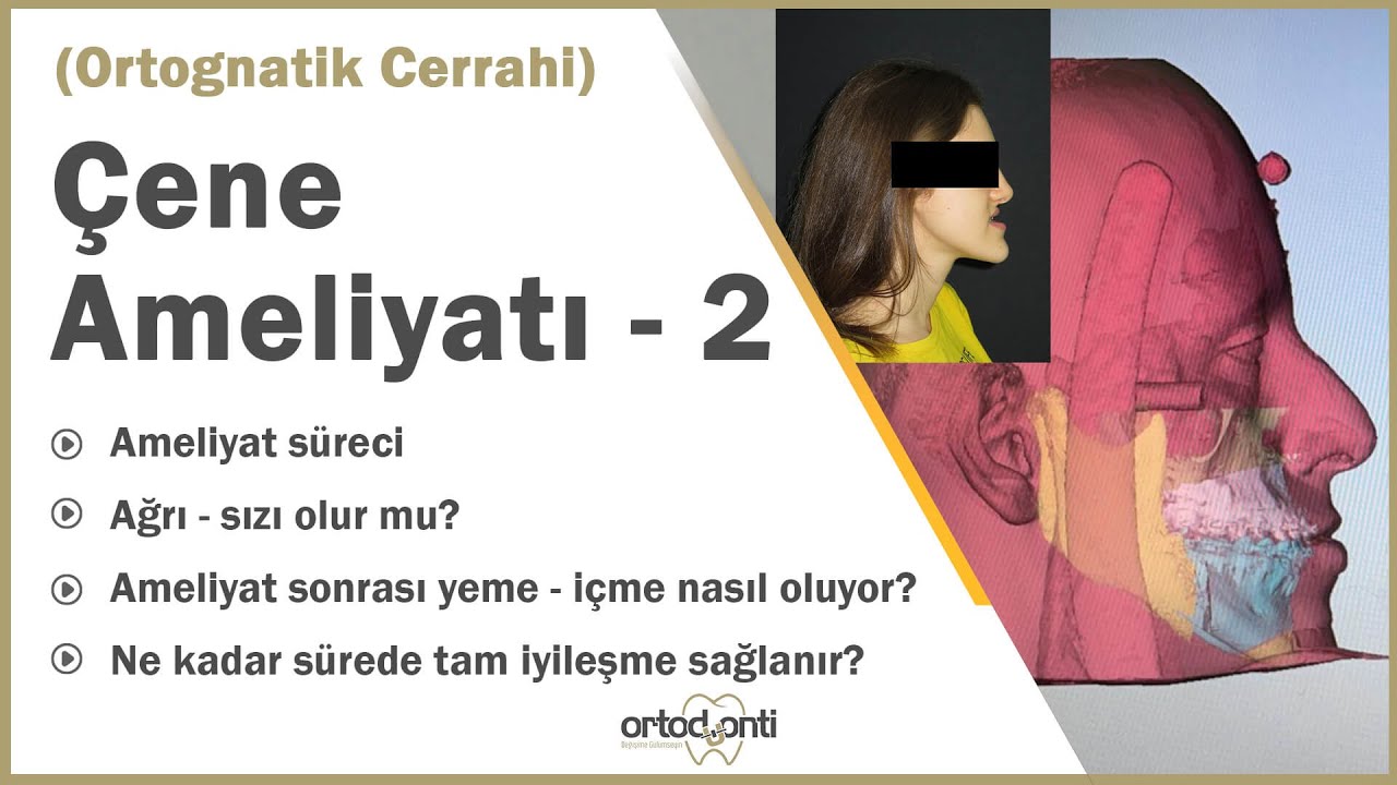 Ortognatik Cerrahi (Çene Ameliyatı) Sonrası Ağrı Olur Mu? Tam İyileşme Ne Zaman Gerçekleşir?