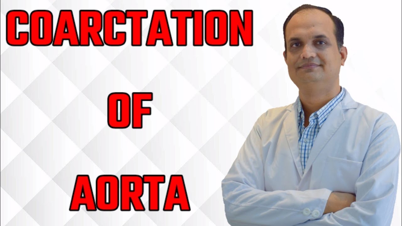 Coarctation of aorta