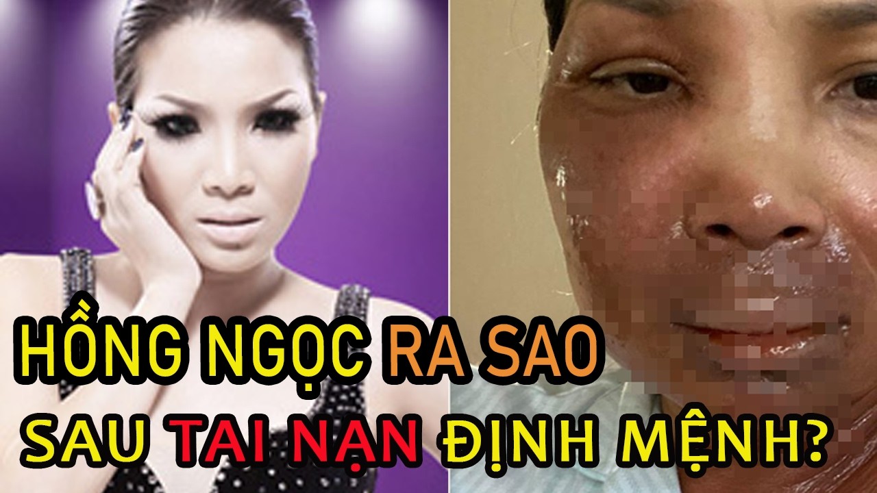 Hồng Ngọc: Từ “cô bé mắt nai” đến tai nạn bỏng suýt hủy hoại sự nghiệp