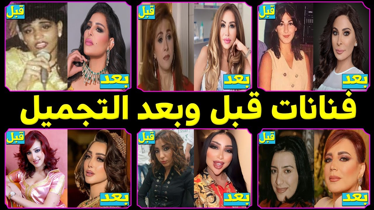 فنانات قبل وبعد عمليات التجميل