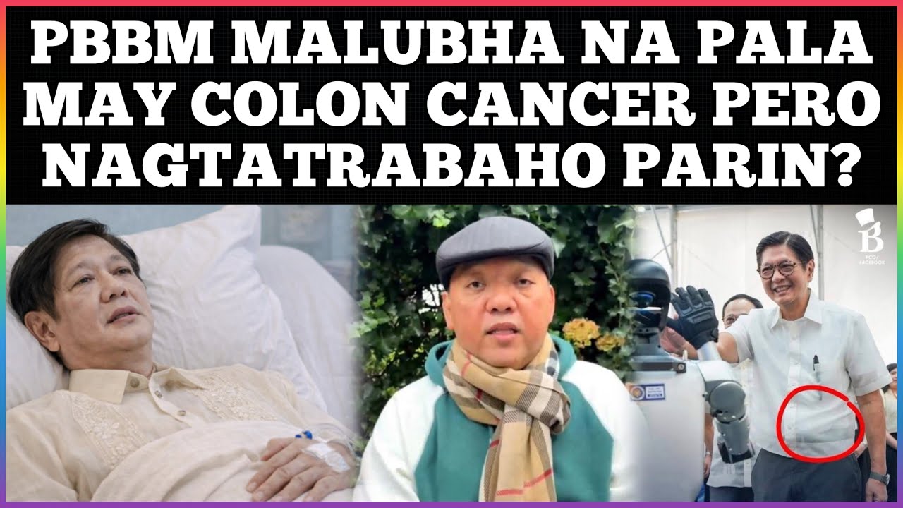 Hala! Pbbm may Colon Cancer na pala ayon sa mga DDs? Satage 4 na at malubha na?