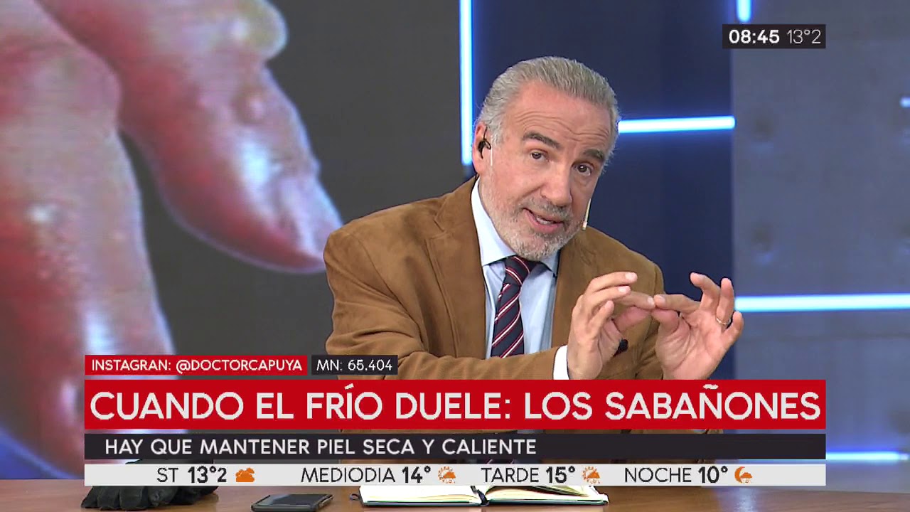 El Consultorio del Dr. Capuya: &iquest;Qu&eacute; son los saba&ntilde;ones?