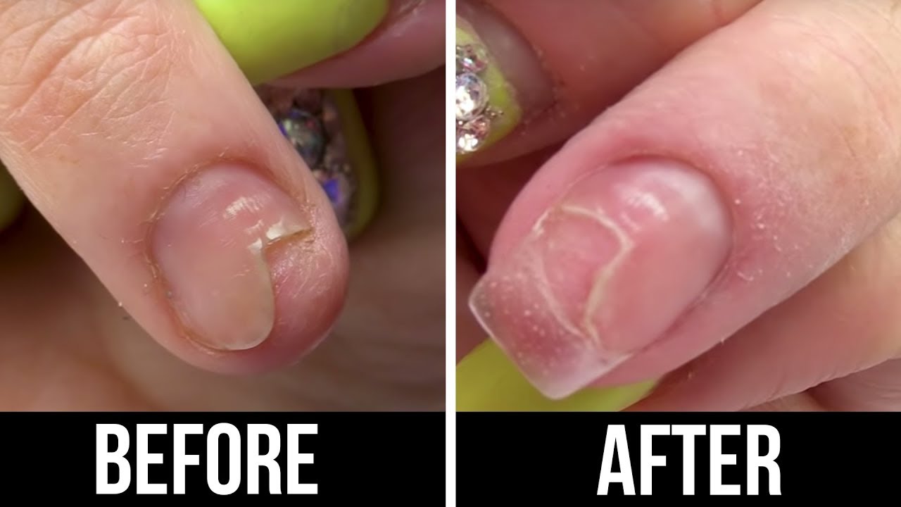 I BROKE MY NAIL AGAIN!!! 😱😱😱