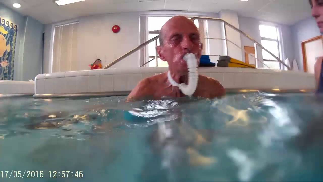 Swimming with an Aquather After Tracheostomy Laryngectomy