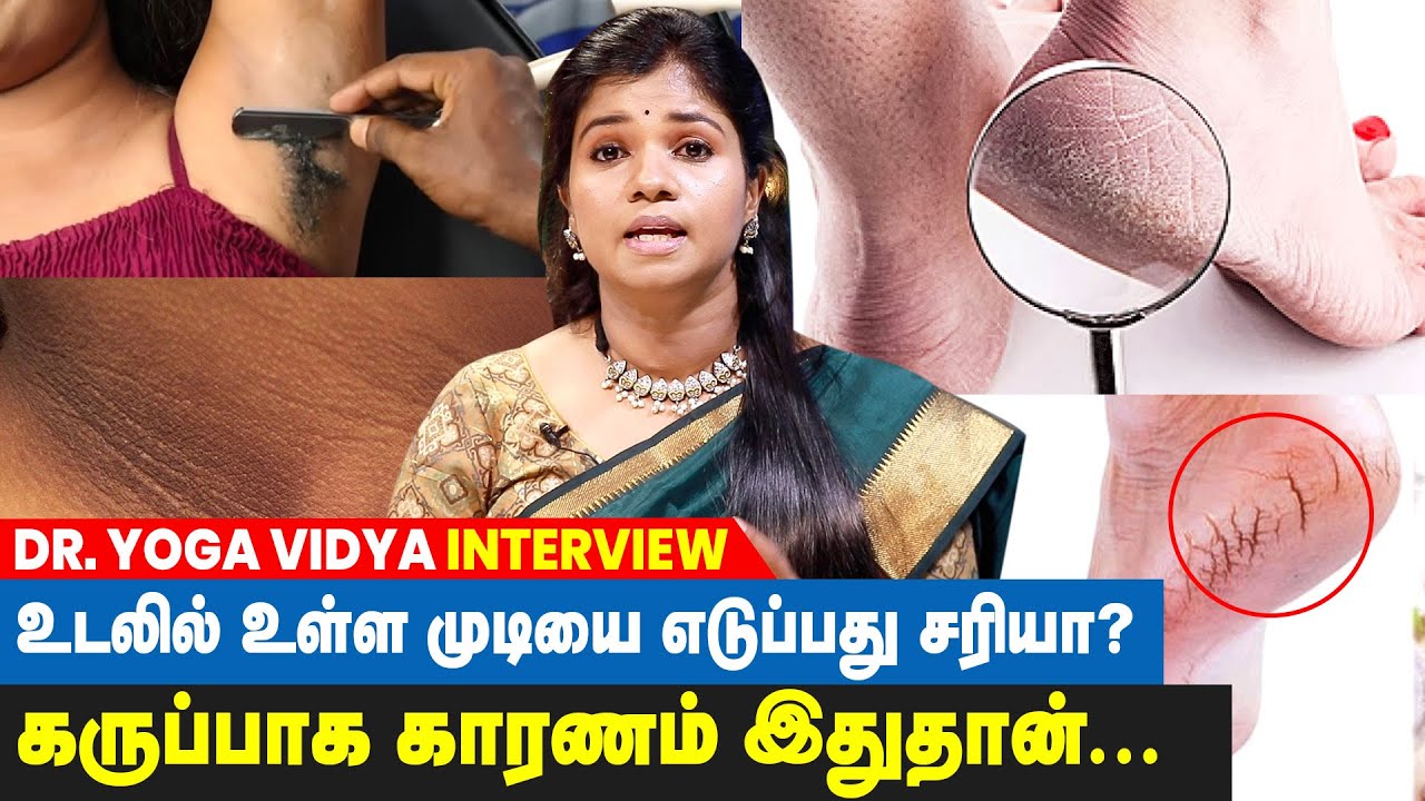”மருதாணி வைத்தால் பித்தம் குறையுமா?” - Dr Yoga Vidhya விளக்கம்