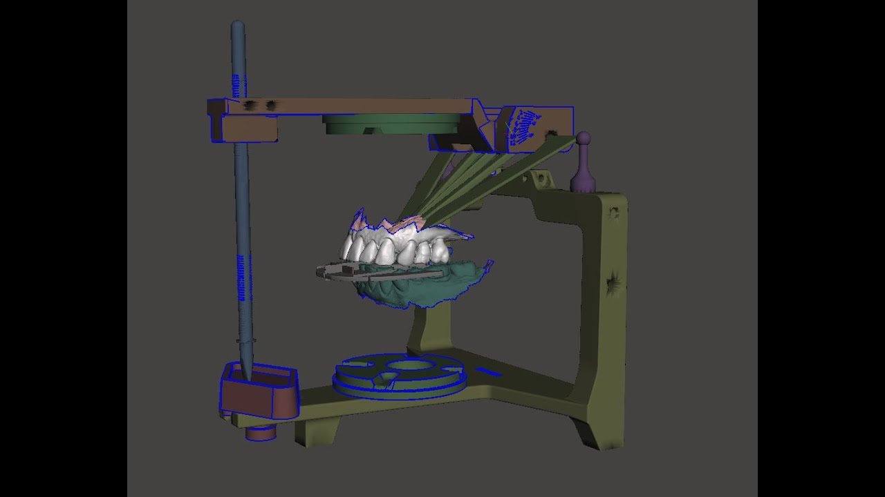 Using Meshmixer to Open or Close VDO