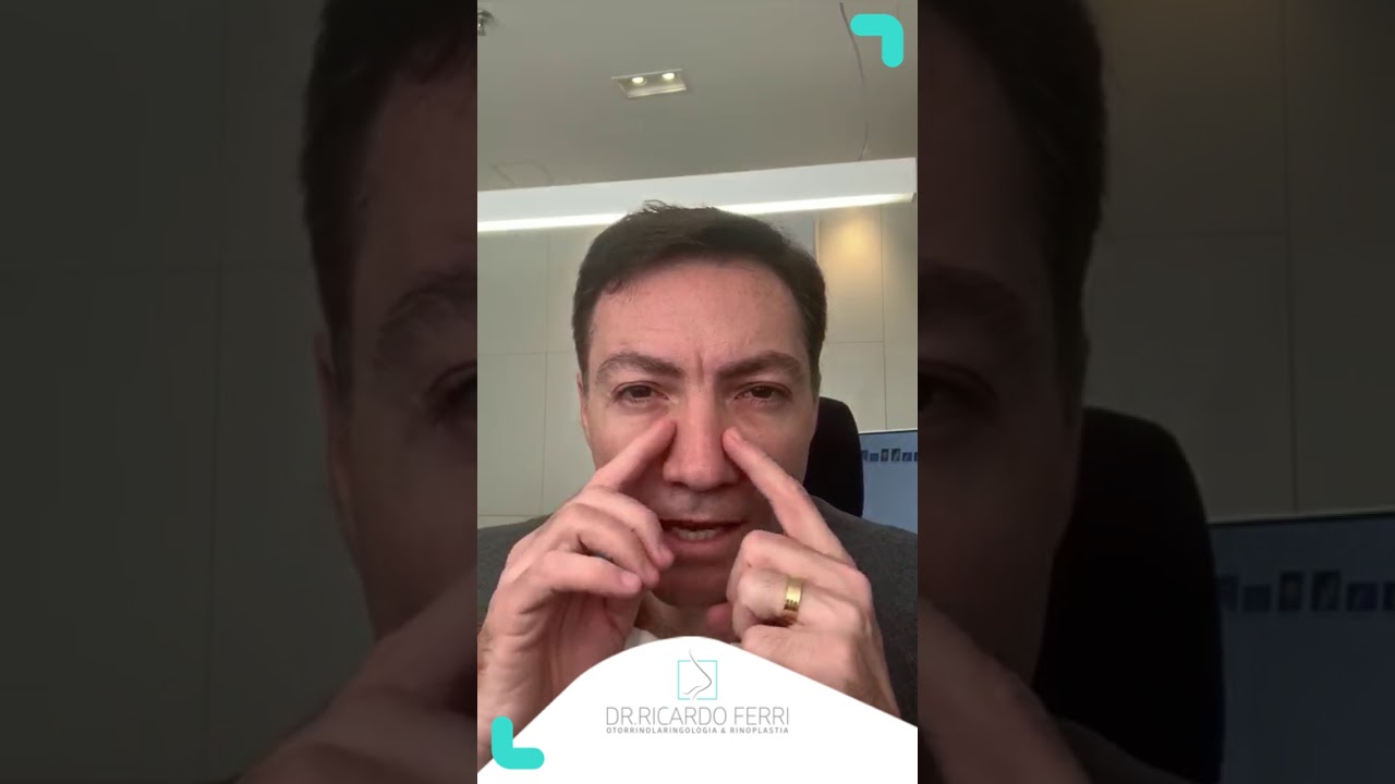 Rinoplastia Secundária - O resultado fica natural?