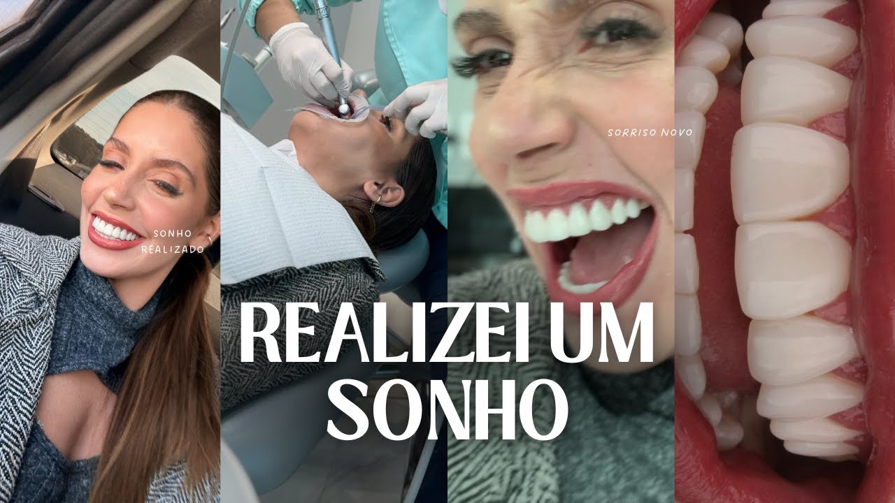 ANTES E DEPOIS: MINHA TRANSFORMAÇÃO COM LENTES DE RESINA EM FLORIANÓPOLIS