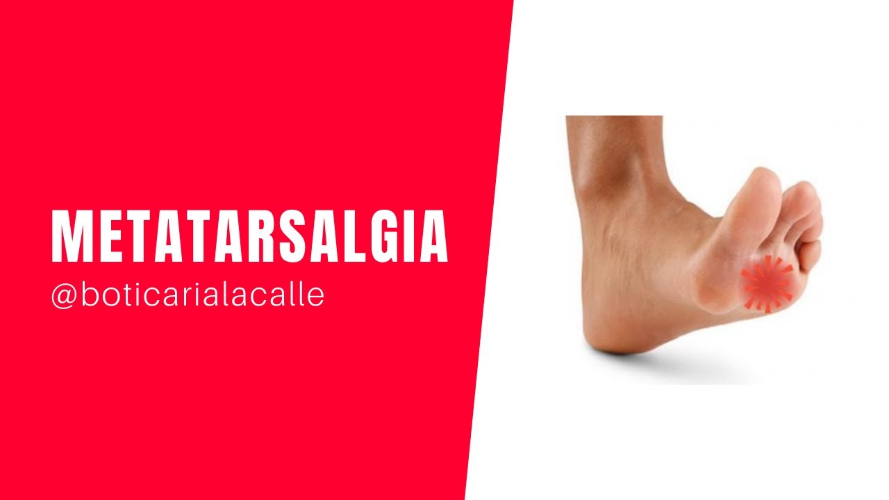 Metatarsalgia