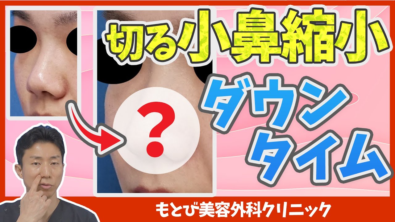 【鼻整形】切る小鼻縮小（鼻翼縮小）のダウンタイム｜傷はどのくらい目立つ？