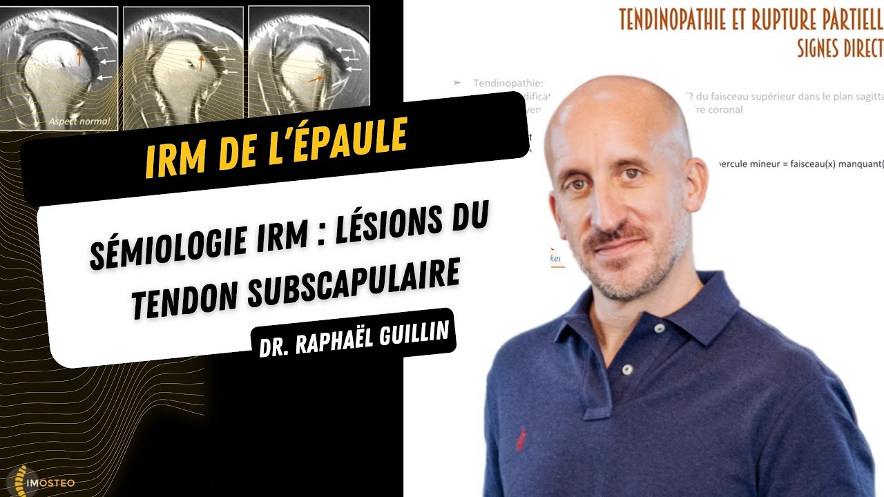 TUTORIEL IMOSTEO #10 : Sémiologie IRM des lésions du tendon subscapulaire