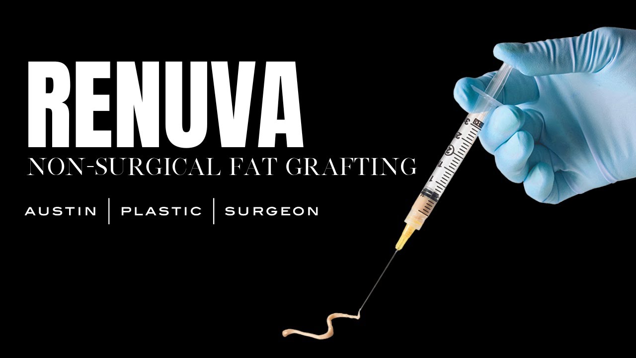 Renuva Transformation - Non Surgical Fat Grafting Solution