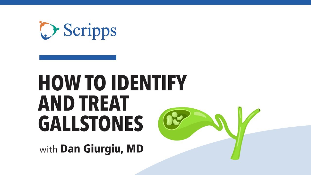 What Do Gallstones Feel Like? with Dr. Dan Giurgiu | San Diego Health
