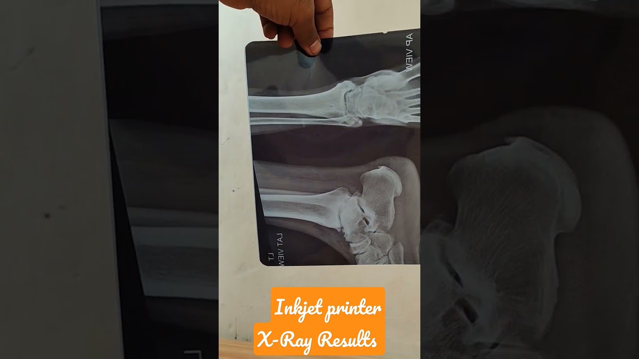 inkjet printer x-ray Results